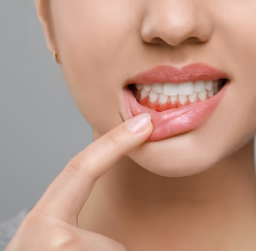 Swollen Gums Around a Single Tooth: What It May Mean