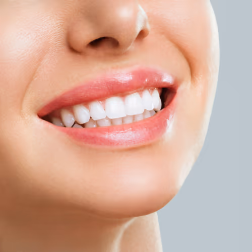 How Veneers Can Improve The Shape Of Your Teeth (Not Just The Color)